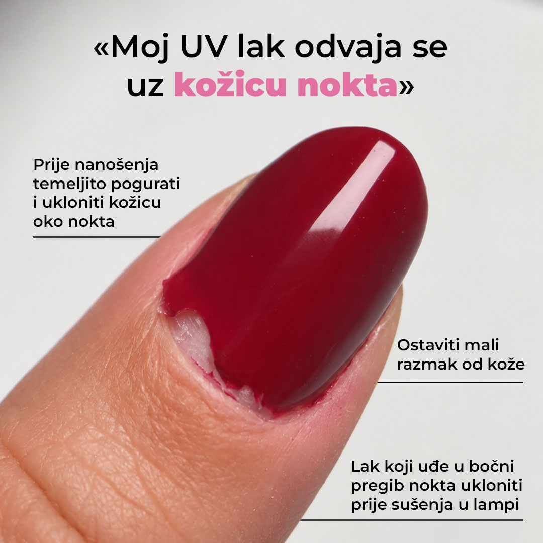 Gel lak se odvaja uz stražnji rub nokta