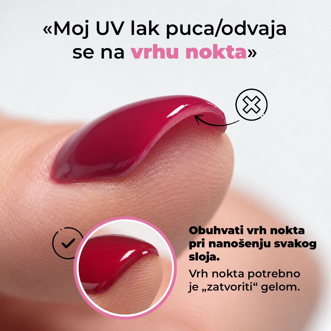 Gel lak se odvaja na vrhu nokta